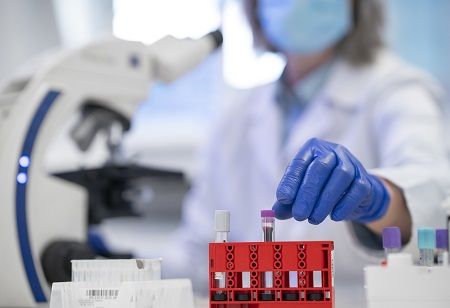 Agilus Launches Advanced Obesity Test Suite for Metabolic Care